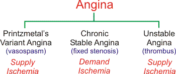 Types of angina